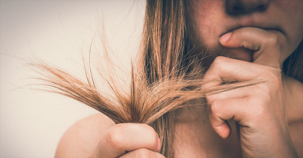 Dry-Damaged-Hair